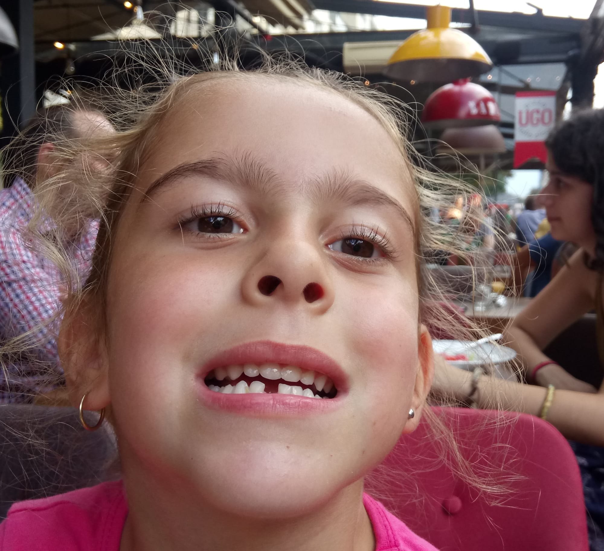 Алина щърбалана